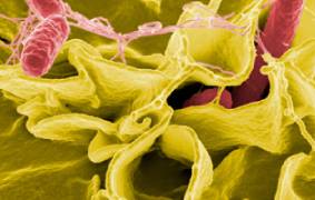 Microbiología